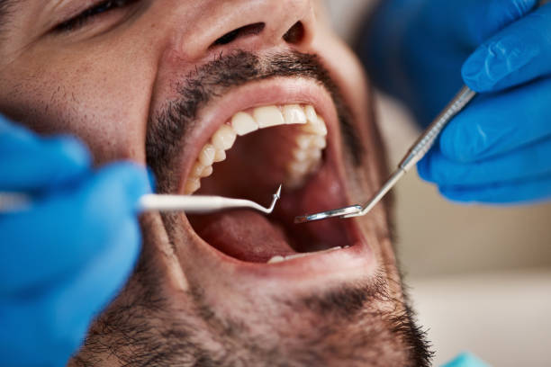 Best Emergency Treatment for Dental Infections or Abscesses in East Rancho Dominguez, CA